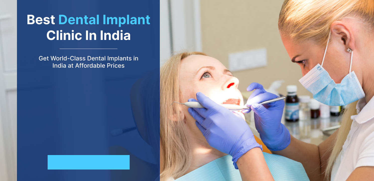 Full Mouth Implant In India | Dental Implant Clinic In India