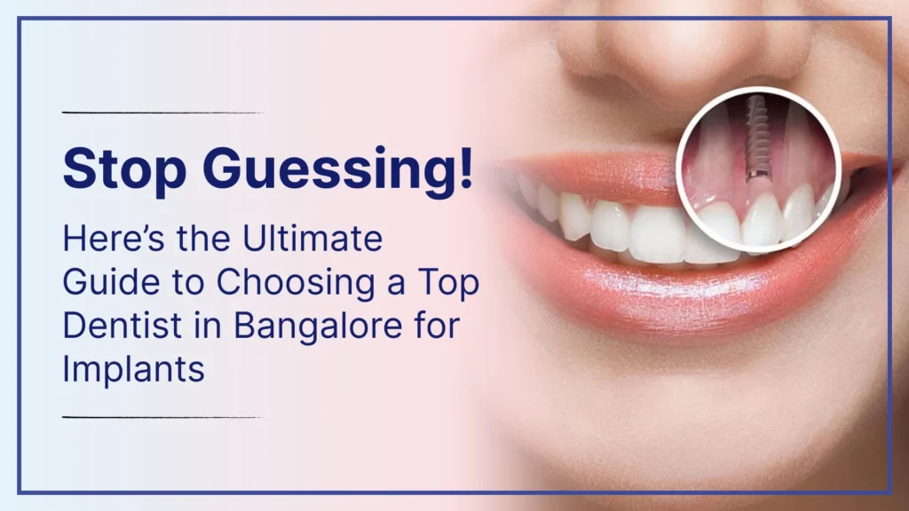 Stop Guessing! Here’s the Ultimate Guide to Choosing a Top Dentist in Bangalore for Implants
