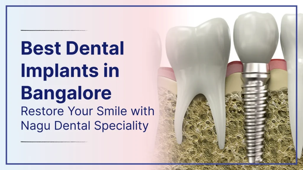 Best Dental Implants in Bangalore – Restore Your Smile with Nagu Dental Speciality