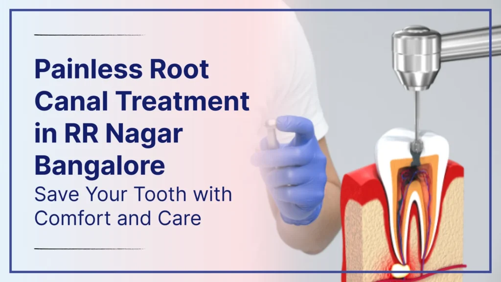 Painless Root Canal Treatment in RR Nagar Bangalore – Save Your Tooth with Comfort and Care