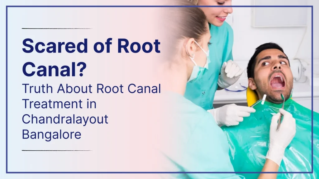 Scared of Root Canal? Truth About Root Canal Treatment in Chandralayout Bangalore