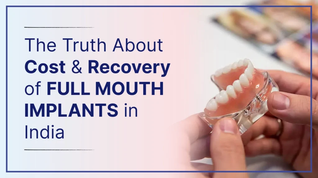 The Truth About Cost & Recovery of Full Mouth Implants in India
