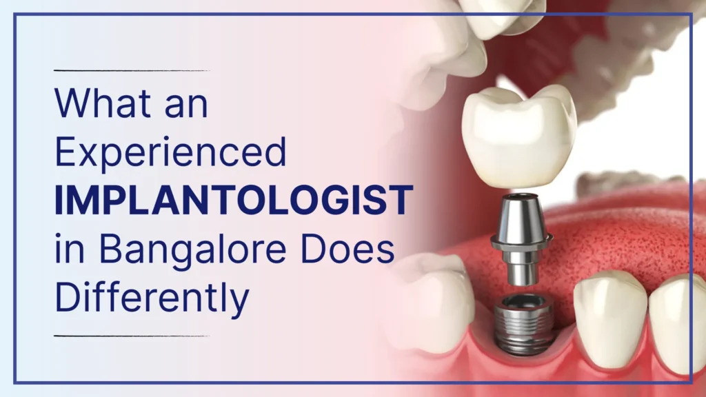 What an Experienced Implantologist in Bangalore Does Differently